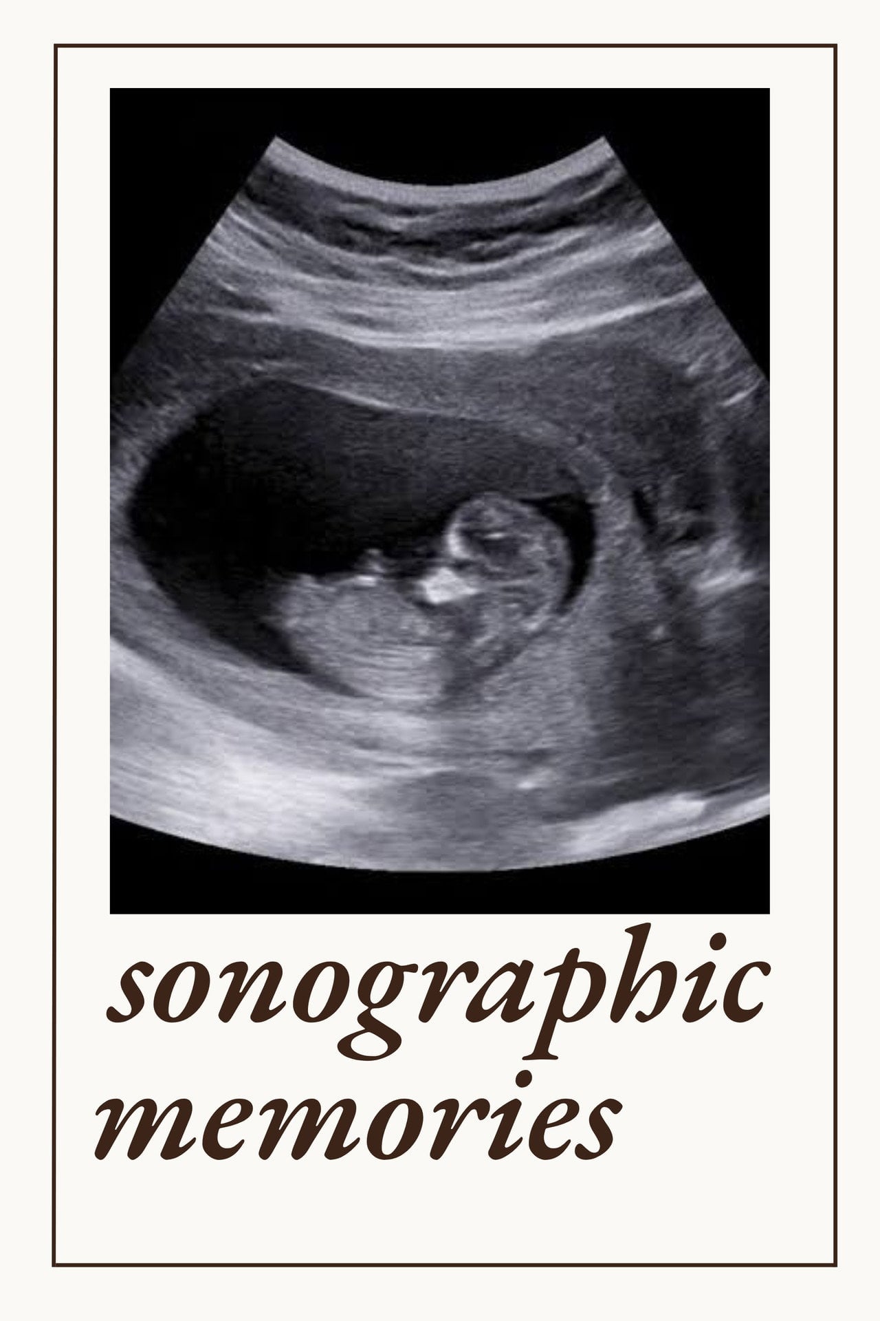 Sonographic Memories